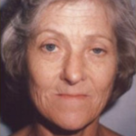 Facial Rejuvenation Before & After Patient #121