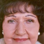 Non-Surgical Facelifts Before & After Patient #834