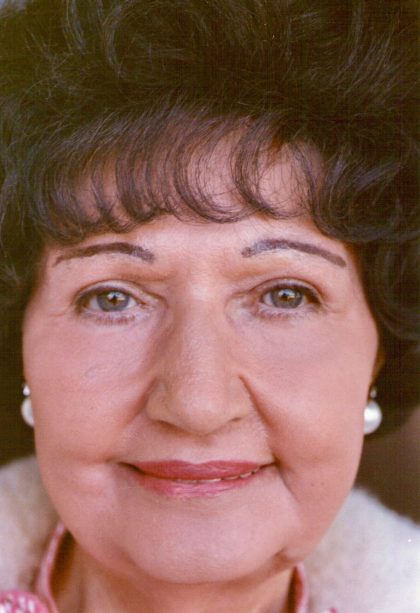 Non-Surgical Facelifts Before & After Patient #834
