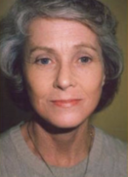 Facial Rejuvenation Before & After Patient #121