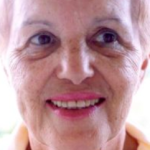 Non-Surgical Facelifts Before & After Patient #130