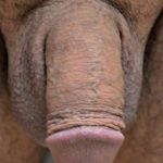Permanent Penis Enlargement Before & After Patient #1440
